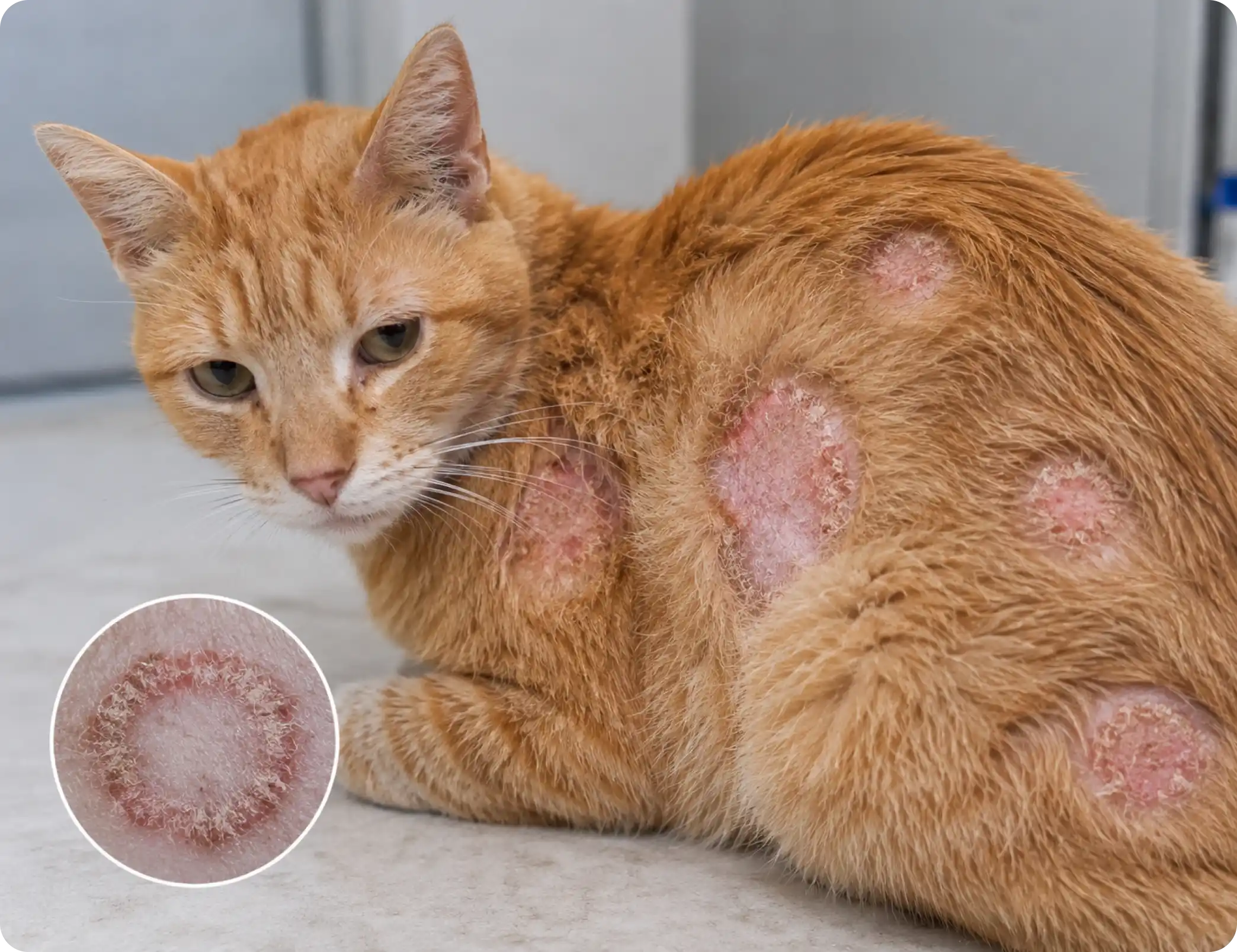 Ringworm