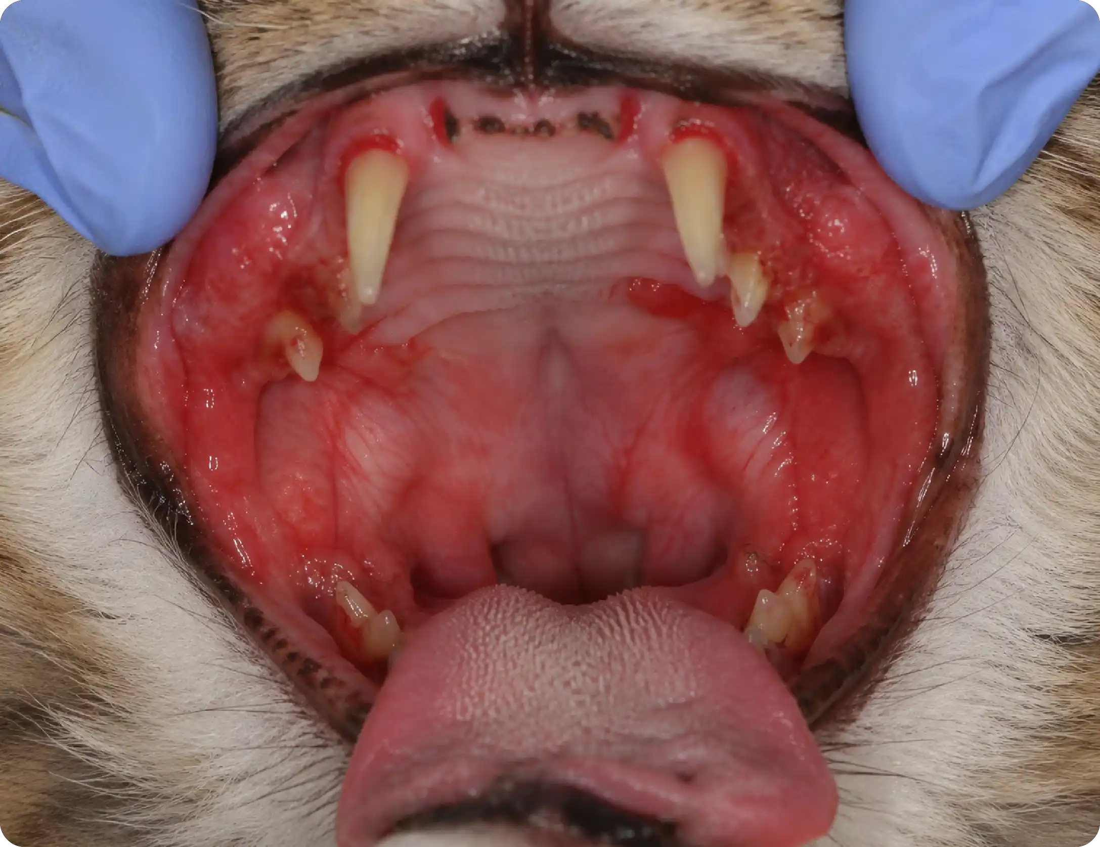Stomatitis